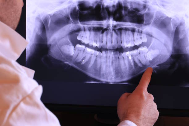 Best Walk-In Emergency Dental Services in Lincoln Beach, OR